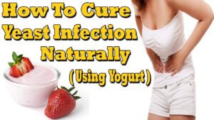 Curing Yeast Infection